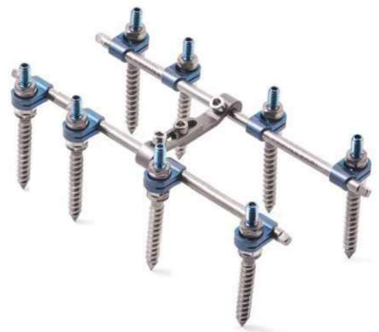 Транспедикулярна система фіксації хребта з напівсферичними поліаксіальними гвинтами "Tria" (8 гвинтів)